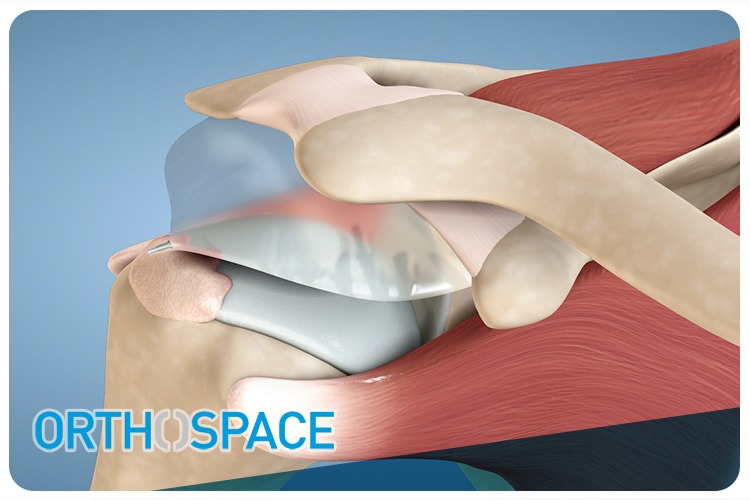 Orthospace sold for $220 million