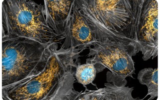 Eukaryotes & Sex