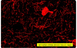 The link between the Herpes virus and Alzheimers