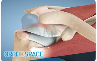 Orthospace sold for $220 million